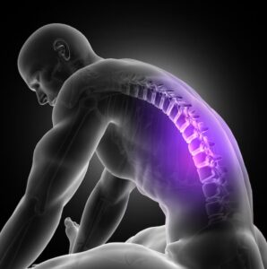 cauzele și diagnosticul stenozei spinale